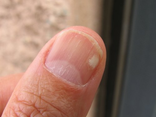 My Thumb